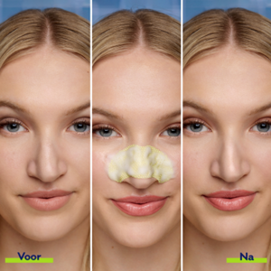 BNP Secondary Images_NL_5-400